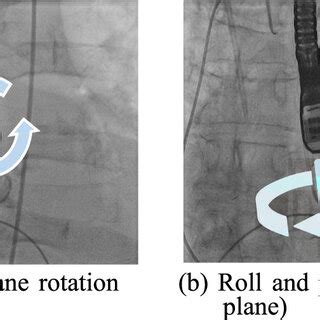 Image result for Miniplane Microplane Adult 2D and 3D TEE Probe
