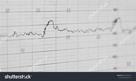 Image result for ECG Graph Paper