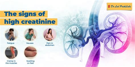 Afbeeldingsresultaten voor Normal Creatinine Levels Chart