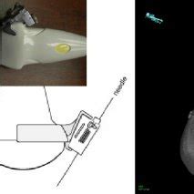 Toradh íomhá ar 2D Matrix Probe