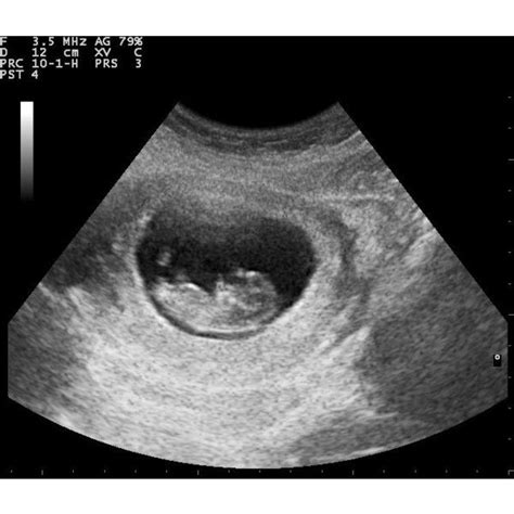 Afbeeldingsresultaten voor Ultrasound ID Code Roblox