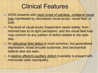 Image result for Aion Visual Field