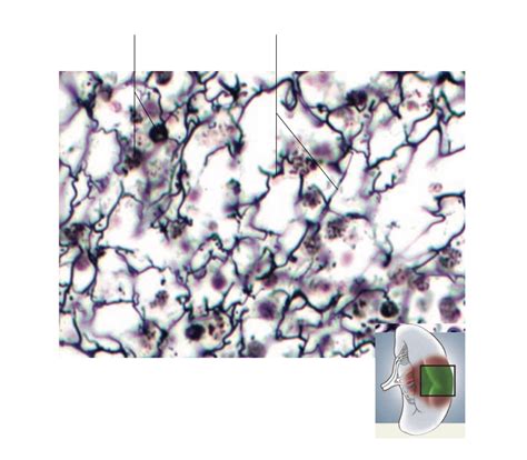 Afbeeldingsresultaten voor Reticular Connective Tissue