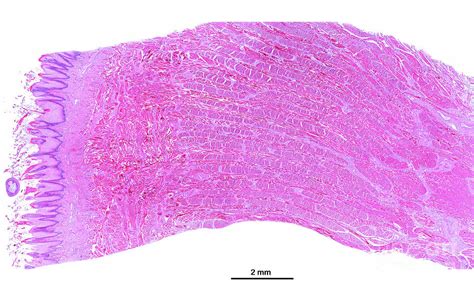 Toradh íomhá ar Filiform Papillae