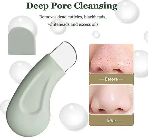 Blackhead And Whitehead Removal Tool For Nose And Face - Skin Pore Cleaner Skin