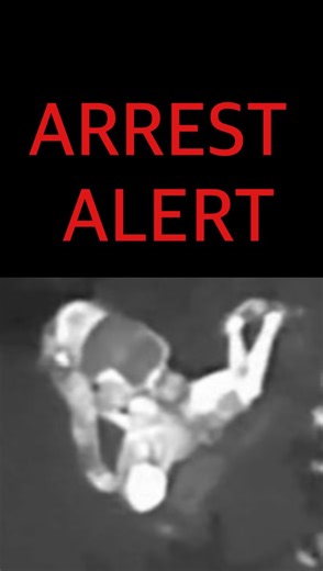 HOLLYWOOD POLICE DEPARTMENT on Instagram: "🚨 ARREST ALERT 🚨 Last week, Hollywood Police Officers were called out to a Strong-Arm Robbery at a convenience store on N Federal Highway. The suspect took off and officers established a perimeter. The Broward Sheriff’s Office Aviation Unit was requested to assist finding the suspect. The suspect was spotted trying to conceal himself in a bush. HPD officers took the suspect into custody without incident. Thanks to the seamless collaboration between HP