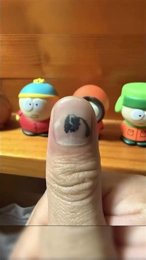 How long will it take for the nail to heal