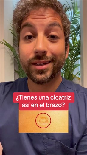 ¿Qué significa tener una cicatriz en el brazo? Descúbrelo aquí