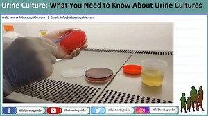 Urine Culture Procedure, Preparation, and Interpretation of Results