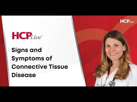 Signs and Symptoms of Connective Tissue Disease