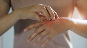 12 Skin Conditions You Should Know About