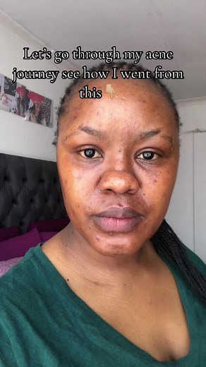 Gentle Magic Skincare Routine Tips for Clear Skin