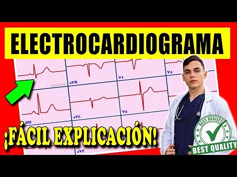 ELECTROCARDIOGRAMA Interpretación