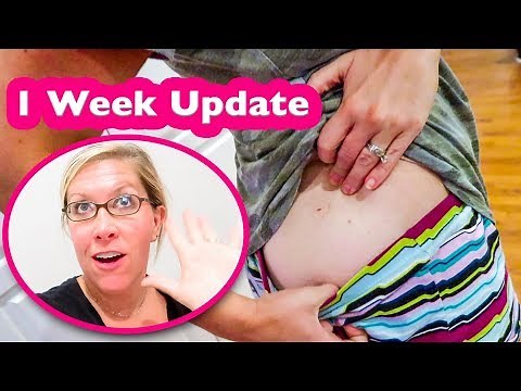 Testosterone Pellet Procedure + 1 Week Update