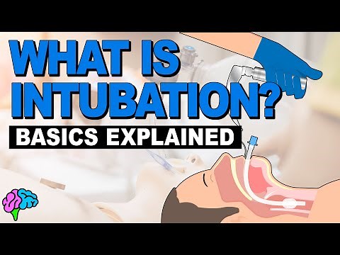 What is Intubation? - The Basics Explained