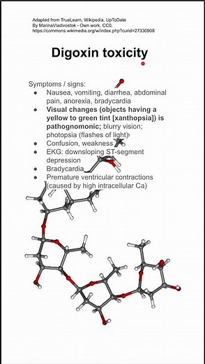 Digoxin toxicity