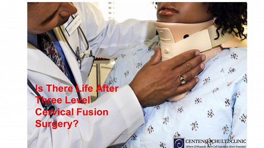 9 Complications to Watch Out For After Cervical Fusion Surgery