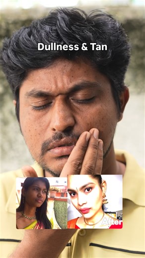 Jiore Skincare on Instagram: "Dont let dullness takeover. Clear darkspots in 15 days. For more details dm free skin consultation ❤️🔥 Shop Link in Bio 🛍️🔗🛒 Vigwa Facial Soap For hyper pigmentation and uneven skin tone. Infused with Kojic acid is a powerful skin-brightening ingredient🎀 It Answers all your questions ✨ 🍋‍🟩 Get glowing skin naturally 🫐 The best skincare routine for oily skin 💦 How to remove dark spots fast ☀️ Must use sunscreen its best for skin ✅ Toxin-Free | ✅ Long-lasting