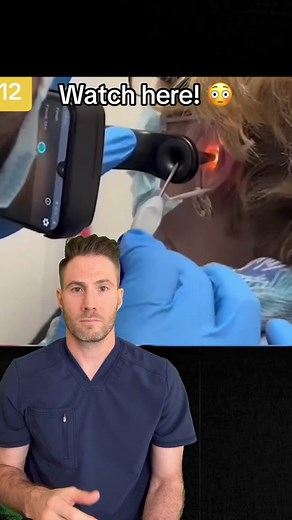 The Dangers of Using Q-Tips to Clean Your Ears