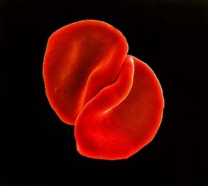 Peter Gabriel - Scratch My Back