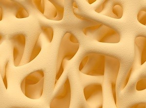 Bone Density Scan (DXA or DEXA)