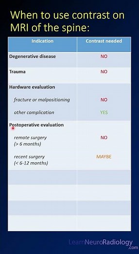 When to use contrast on MRI of the spine #radiology #mri #spine #neuroradiology