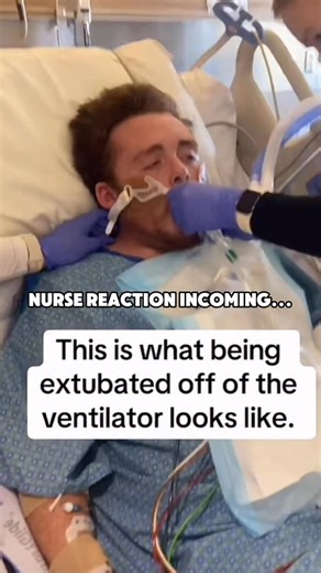 Barbara | BSN, RN on Instagram: "Ever wondered what actually happens when a breathing tube comes out? Extubation isn’t as simple as just pulling the tube. First, the team makes sure the patient is stable, awake enough, and able to breathe on their own. When it’s time, the patient takes a deep breath and coughs — this helps clear secretions and makes the removal smoother Post-extubation, nurses: monitor SPO2 levels asses breathing effort assess for stridor (high-pitched sound that can mean swelli