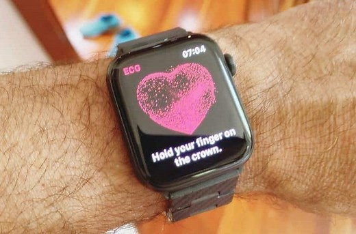 The Best ECG Smartwatches for 2023