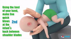 How to help a choking child or infant? Learn First Aid skill and keep your family safe. | First Aid