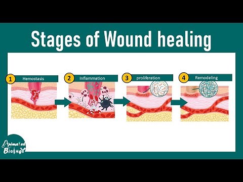 Wound healing stages | steps of wound healing | Wound healing and injury