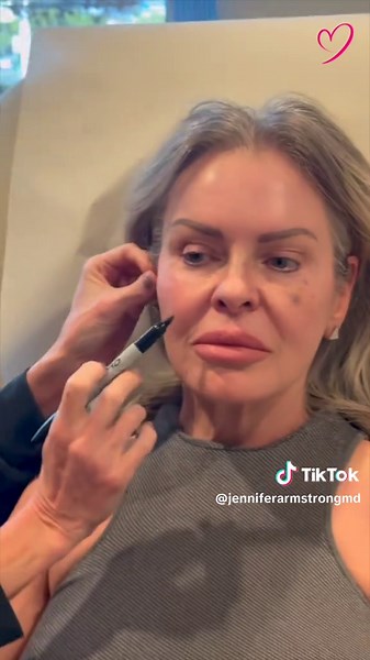 Achieve a Youthful Look in 30 Minutes with Threads