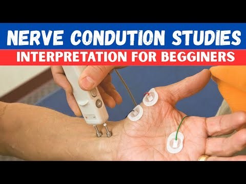 Nerve Conduction Study (NCS) Interpretation Simplified | Step-by-Step Guide