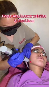 10K views · 63 reactions | DON'T MISS OUT: Aura Ruz PICOSURE PRO...