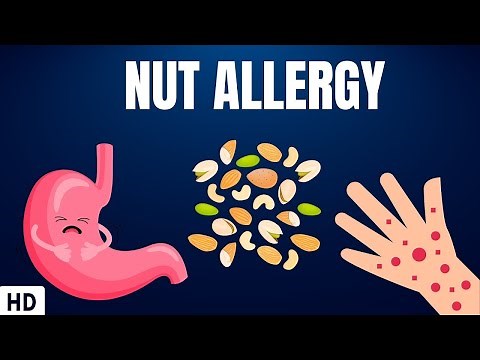 Nut Allergy: Everything You Need To Know