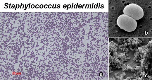 Staphylococcus epidermidis- An Overview - Microbe Notes