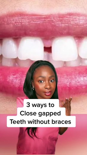 Attractive Gapped Teeth: Natural Fixes Without Braces