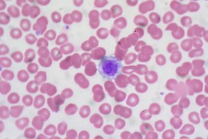 Platelets -  Function, Thrombocytopenia, Aggregation, Count/Microscopy