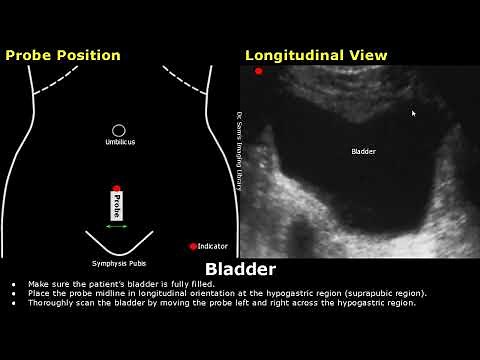 How to Scan The Bladder On Ultrasound | Probe Positioning | Transducer Placement | Abdominal USG