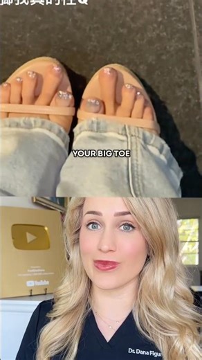Do you have this rare foot type?!