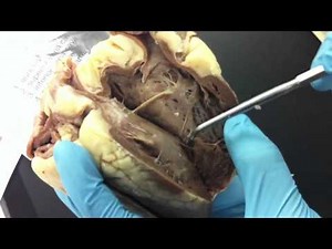 Sheep heart dissection