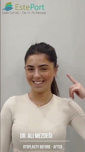 Young Girl’s Incredible Ear Surgery Transformation! (Before & After)