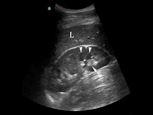 Proper Depth in Ultrasound imaging