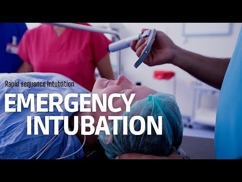 Emergency Intubation (RSI) in ER: step by step approach