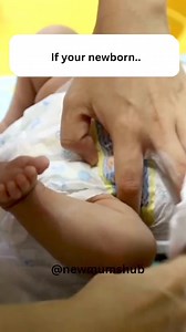 31K views · 113 reactions | Understanding Your Newborn’s Stool...