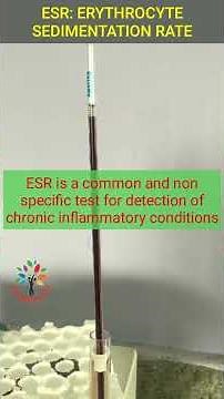 Erythrocyte Sedimentation Rate Physiology Practical ll Types ll Normal Range