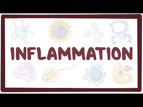 Inflammation - causes, symptoms, diagnosis, treatment, pathology