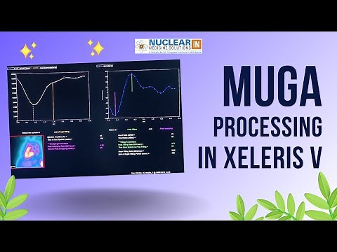 MUGA processing in Xeleris 5