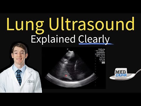 Lung Ultrasound Explained (Point of Care, Bedside, Clinical)
