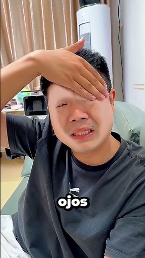 Mi Hermano Se Borró La Cara! 😱