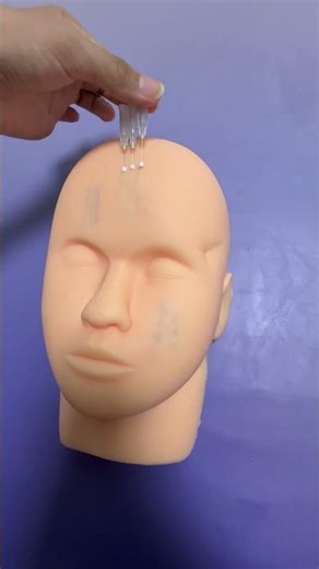 💫 How Does Thread Lift Work?